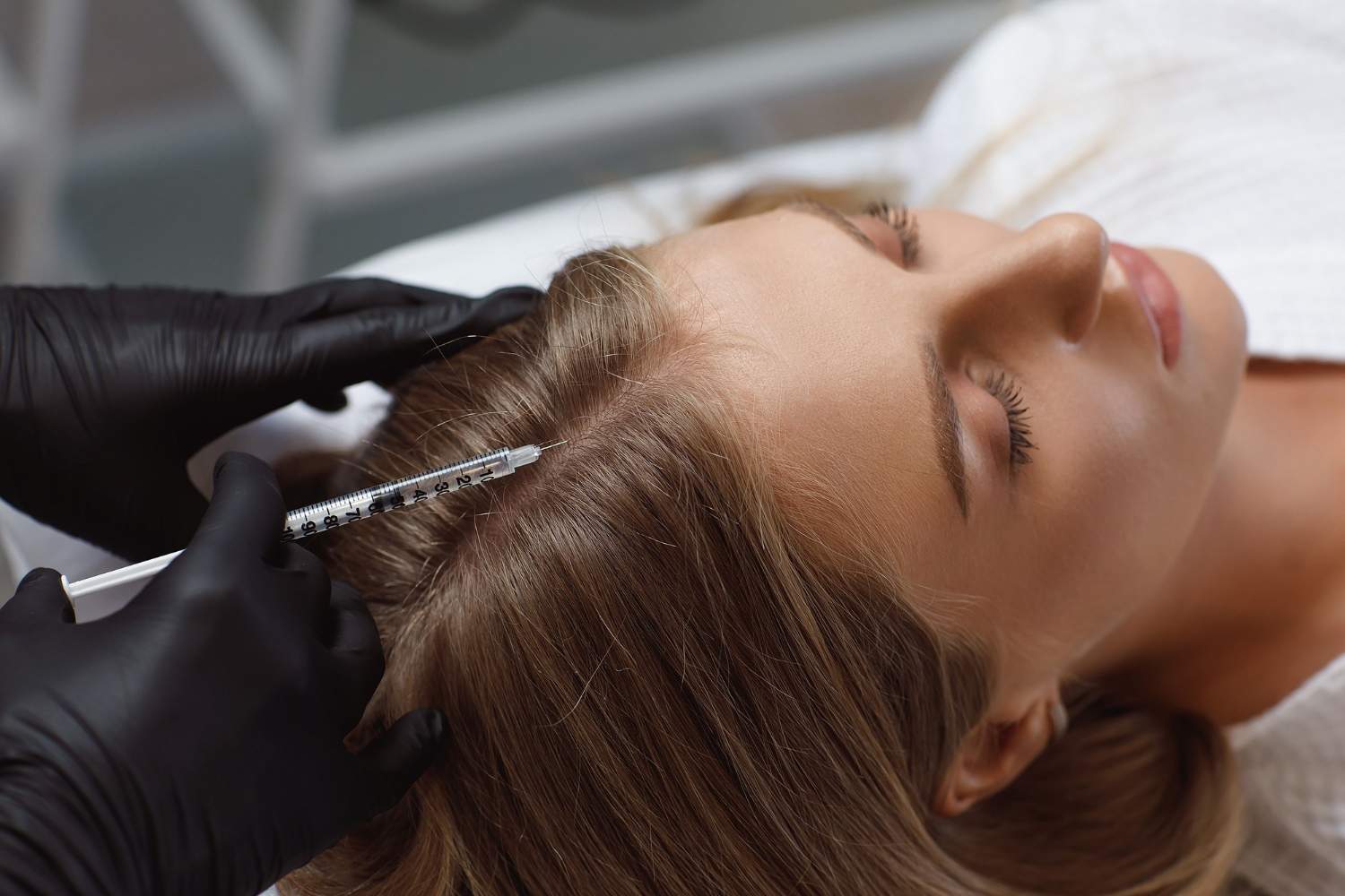 Mesoterapia capilar con Derma Pen en Castelldefels