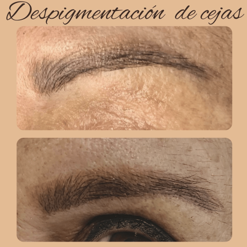 cejas